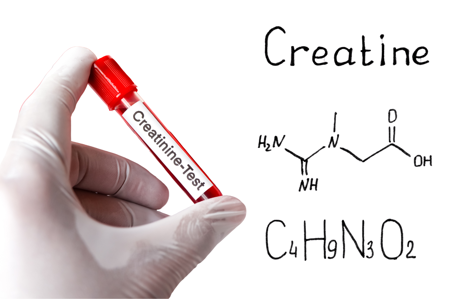 Creatine and creatinine compared