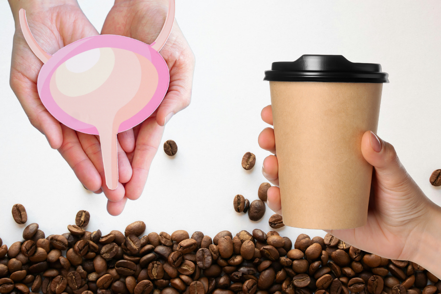 a hand holding a cup of coffee beside hands holding a printed image of a bladder
