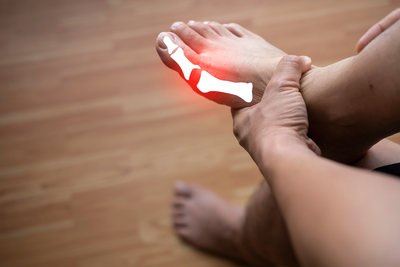 What Does Gout Feel Like in the Early Stages? 5 Warning Signs to Watch