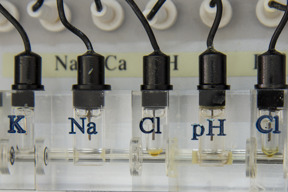 Lab equipment measuring sodium and potassium levels related to electrolyte balance and gout