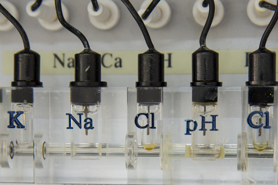 Lab equipment measuring sodium and potassium levels related to electrolyte balance and gout