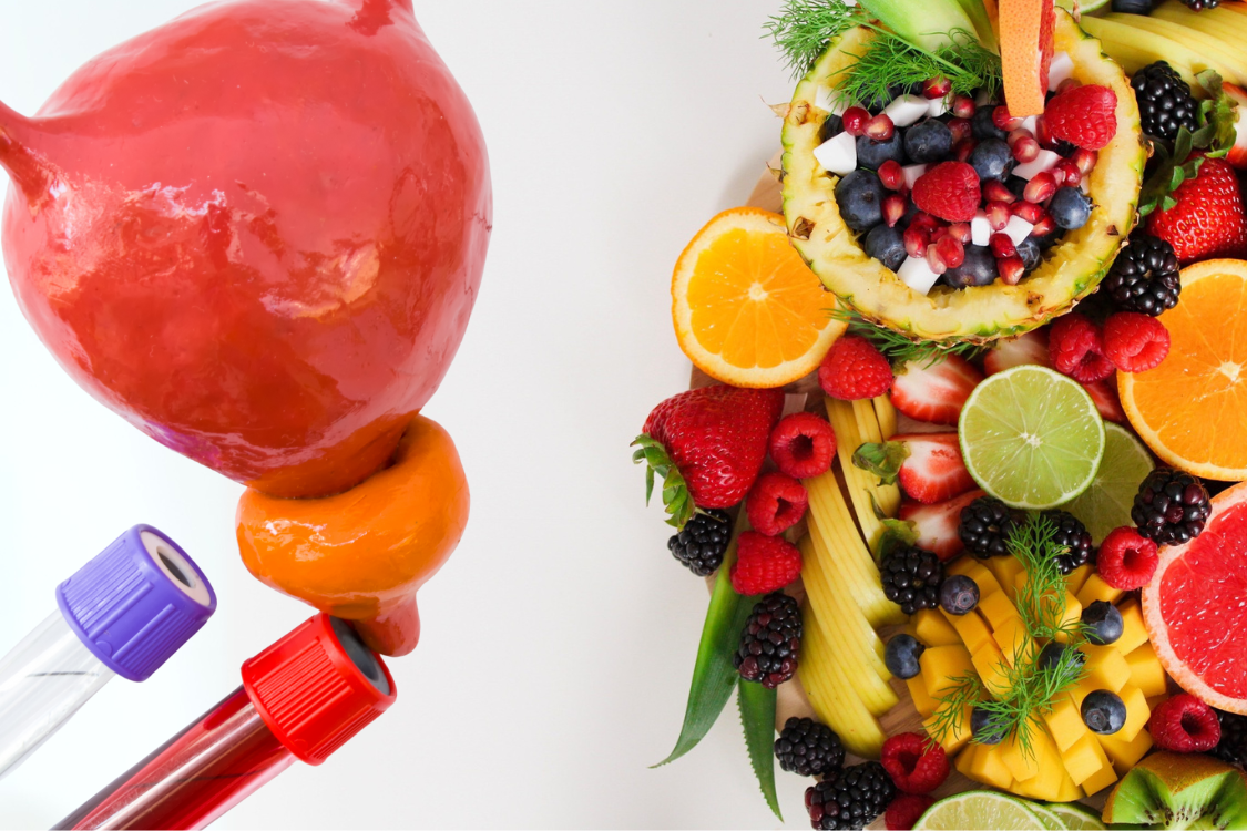 Fruits like watermelon, orange, grapes, and pomegranate placed next to a prostate model, highlighting foods good for prostate health.