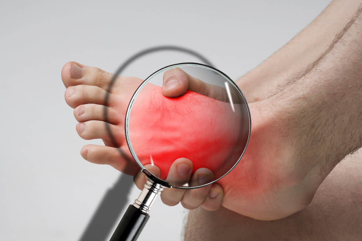 Close-up of painful top-of-foot swelling highlighting possible gout or tendonitis