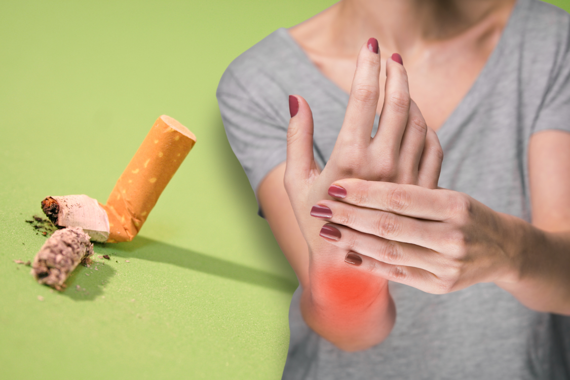 Crushed cigarette and woman with wrist pain, symbolizing smoking's link to gout and joint inflammation