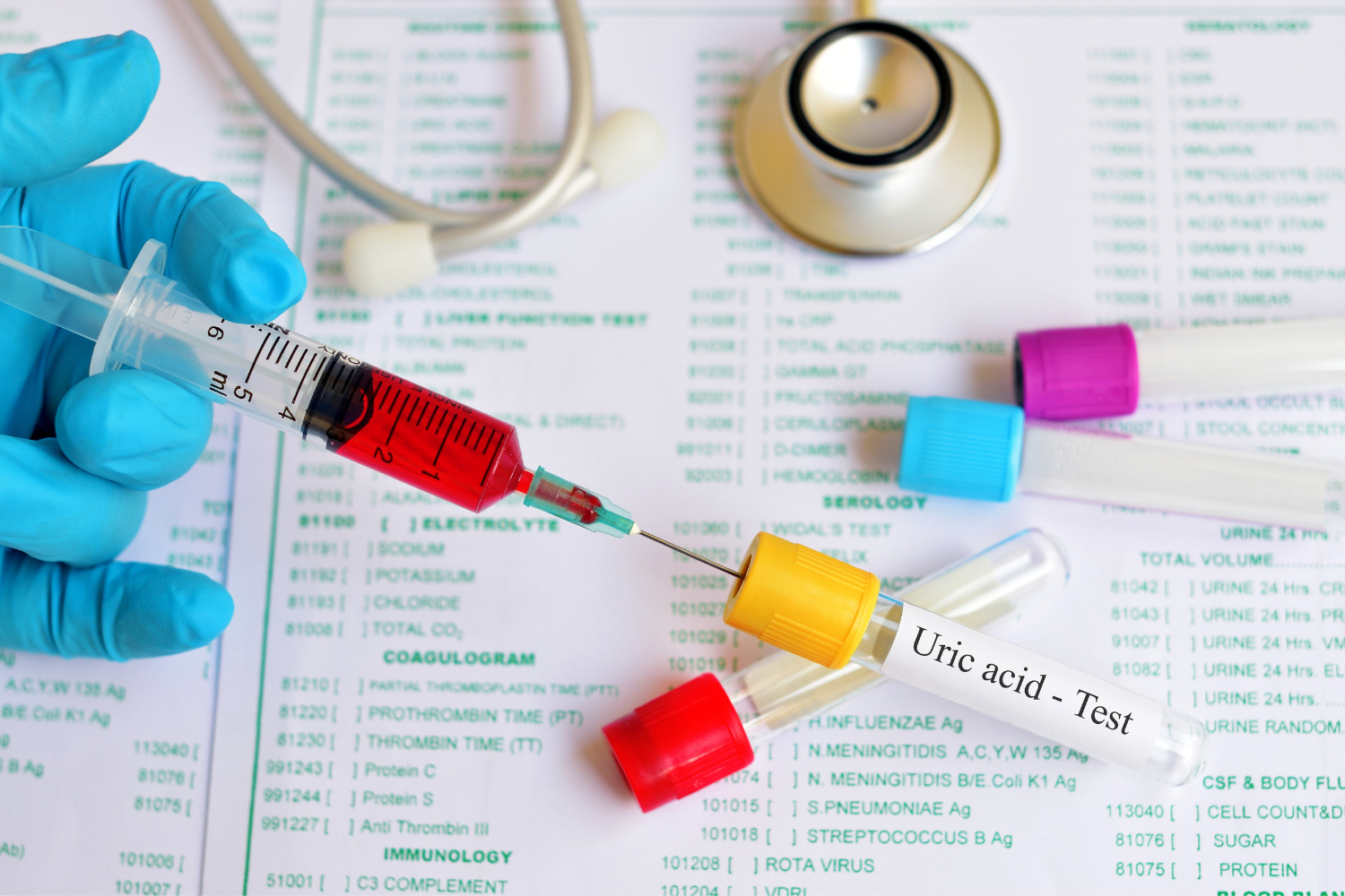 Blood sample for uric acid test