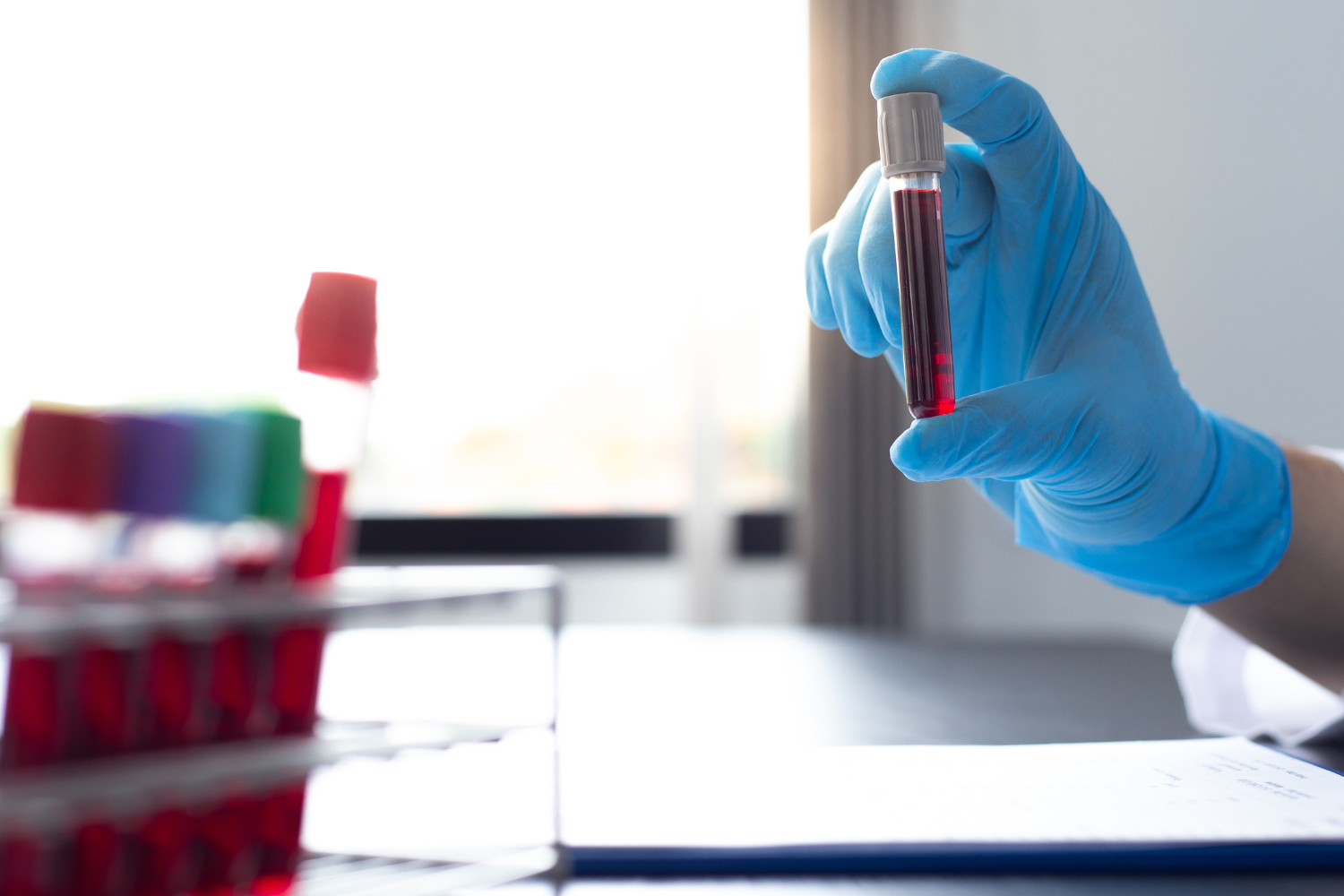 Test tube with blood representing uric acid blood test.