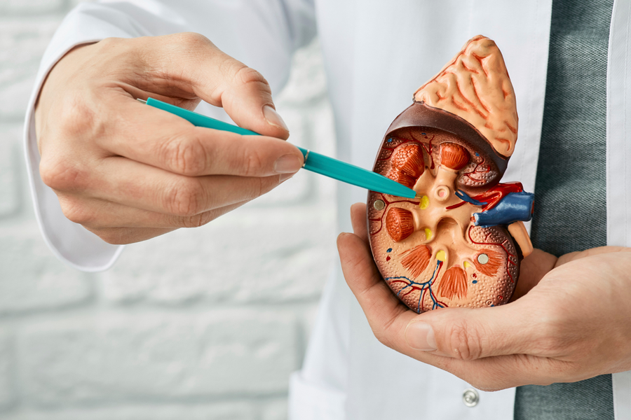 A doctor's hand pointing to a model of a human kidney, indicating the focus on kidney health and the prevention of kidney stones.